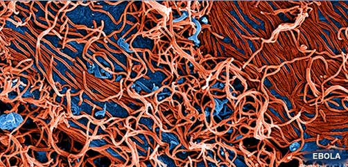 Ebola Virus Closeup - ALLOW IMAGES