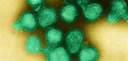 H3N2 Virus - ALLOW IMAGES