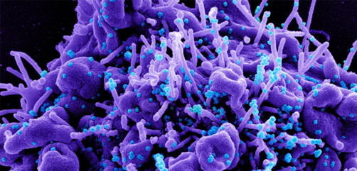 Colorized scanning electron micrograph of an apoptotic cell (purple) infected with SARS-COV-2 virus particles (blue), isolated from a patient sample. Image captured at the NIAID Integrated Research Facility (IRF) in Fort Detrick, Maryland. Credit: NIAID - ALLOW IMAGES