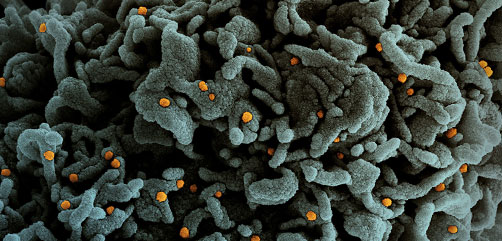 Colorized scanning electron micrograph of a cell (teal) infected with UK B.1.1.7 variant SARS-CoV-2 virus particles (orange), isolated from a patient sample. Image captured at the NIAID Integrated Research Facility (IRF) in Fort Detrick, Maryland. Credit: NIAID - ALLOW IMAGES