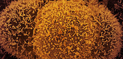 Spherical structures are SARS-CoV-2 virus particles. The string-like protrusions extending from the cells are cell projections or pseudopodium. Image Credit: NIAID - ALLOW IMAGES