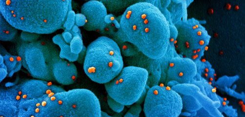 Colorized scanning electron micrograph of an apoptotic cell (blue) infected with SARS-COV-2 virus particles (orange), isolated from a patient sample.  Image Credit: NIAID - ALLOW IMAGES