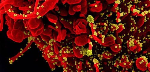 Scanning electron microscopic image of a cell infected with SARS-COV-2 virus particles, shown in yellow. Image: NIAID - ALLOW IMAGES