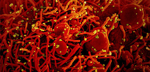 Colourised scanning electron micrograph of an apoptotic cell (red) infected with SARS-COV-2 virus particles (yellow). Credit: NIAID.
 - ALLOW IMAGES