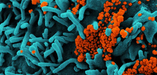 Colorized scanning electron micrograph of a cell (teal) infected with SARS-CoV-2 virus particles (orange), isolated from a patient sample. Image captured at the NIAID Integrated Research Facility (IRF) in Fort Detrick, Maryland. Credit: NIAID - ALLOW IMAGES