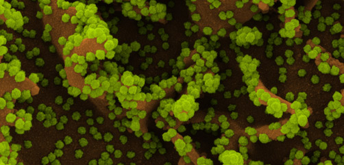 Colorized scanning electron micrograph of a cell (brown) heavily infected with SARS-CoV-2 virus particles (green), isolated from a patient sample. Image captured at the NIAID Integrated Research Facility (IRF) in Fort Detrick, Maryland. Credit: NIAID