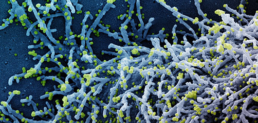 Colorized scanning electron micrograph of a cell infected with a variant strain of SARS-CoV-2 virus particles (yellow), isolated from a patient sample. Image captured at the NIAID Integrated Research Facility (IRF) in Fort Detrick, Maryland. Credit: NIAID