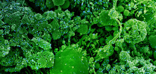 Colorized scanning electron micrograph of chronically infected and partially lysed cells (green) infected with a variant strain of SARS-CoV-2 virus particles (blue), isolated from a patient sample. Image captured at the NIAID Integrated Research Facility (IRF) in Fort Detrick, Maryland. Credit: NIAID - ALLOW IMAGES