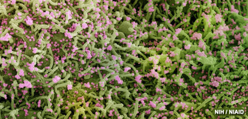 Colorized scanning electron micrograph of chronically infected and partially lysed cells (green) infected with a variant strain of SARS-CoV-2 virus particles (blue), isolated from a patient sample. Image captured at the NIAID Integrated Research Facility (IRF) in Fort Detrick, Maryland. Credit: NIAID - ALLOW IMAGES