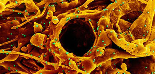 Colorized scanning electron micrograph of a cell (orange) infected with UK B.1.1.7 variant SARS-CoV-2 virus particles (green), isolated from a patient sample. Image captured at the NIAID Integrated Research Facility (IRF) in Fort Detrick, Maryland. - ALLOW IMAGES