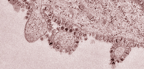 A false-color microscope image of a cell infected with the novel coronavirus, grown in culture at the University of Hong Kong - ALLOW IMAGES