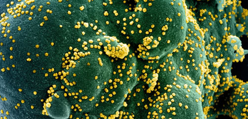 This scanning electron microscope image by the National Institute of Allergy and Infectious Diseases shows SARS-CoV-2 (yellow), the virus that causes COVID-19, emerging from the surface of cells. - ALLOW IMAGES