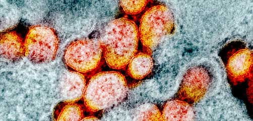 Transmission electron micrograph of SARS-CoV-2 virus particles, isolated from a patient. Image captured and color-enhanced at the NIAID Integrated Research Facility (IRF) in Fort Detrick, Maryland. Credit: NIAID - ALLOW IMAGES