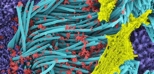 Colorized scanning electron micrograph of an apoptotic cell (blue) infected with SARS-COV-2 virus particles (red), isolated from a patient sample. Image captured at the NIAID Integrated Research Facility (IRF) in Fort Detrick, Maryland. Credit: NIAID- ALLOW IMAGES