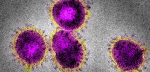Electron micrograph of the coronavirus that caused SARS. - ALLOW IMAGES