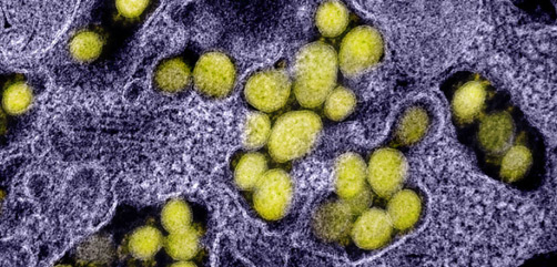 Transmission electron micrograph of SARS-CoV-2 virus particles, isolated from a patient. Image captured and color-enhanced at the NIAID Integrated Research Facility (IRF) in Fort Detrick, Maryland. Credit: NIAID - ALLOW IMAGES