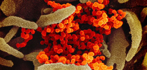 The National Institute of Allergy and Infectious Diseases' (NIAID) Rocky Mountains Laboratories (RML) have released scanning and transmission electron microscope images of the COVID-19 coronavirus. - ALLOW IMAGES