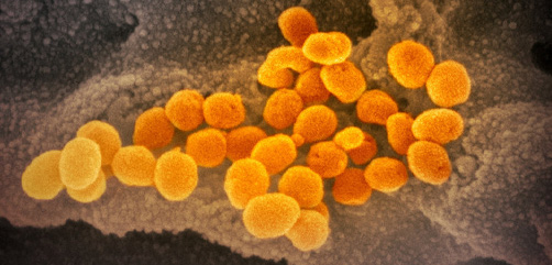Coronavirus Update - ALLOW IMAGES