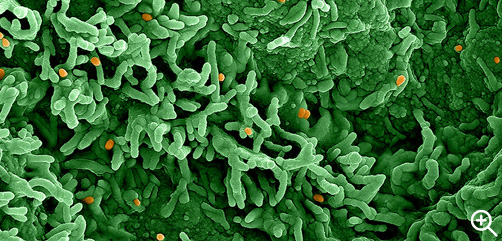 Click to Enlarge - Colorized scanning electron micrograph of monkeypox virus (orange) on the surface of infected VERO E6 cells (green). Image captured at the NIAID Integrated Research Facility (IRF) in Fort Detrick, Maryland. Credit: NIAID - ALLOW IMAGES
